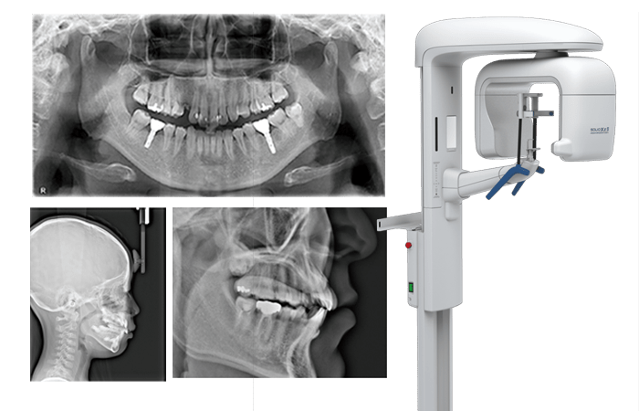 歯科用レントゲン・CT